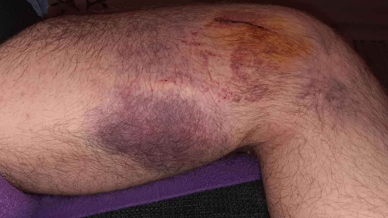 Trailpark Harz Bild 7